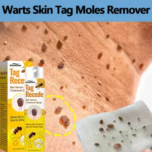 Penghilang Kutil Dan Tahi Lalat Obat Penghilang Kutil Penghilang Tahi Lalat Di Wajah Obat Kutil Ampuh Skin Tag Remover [S09]