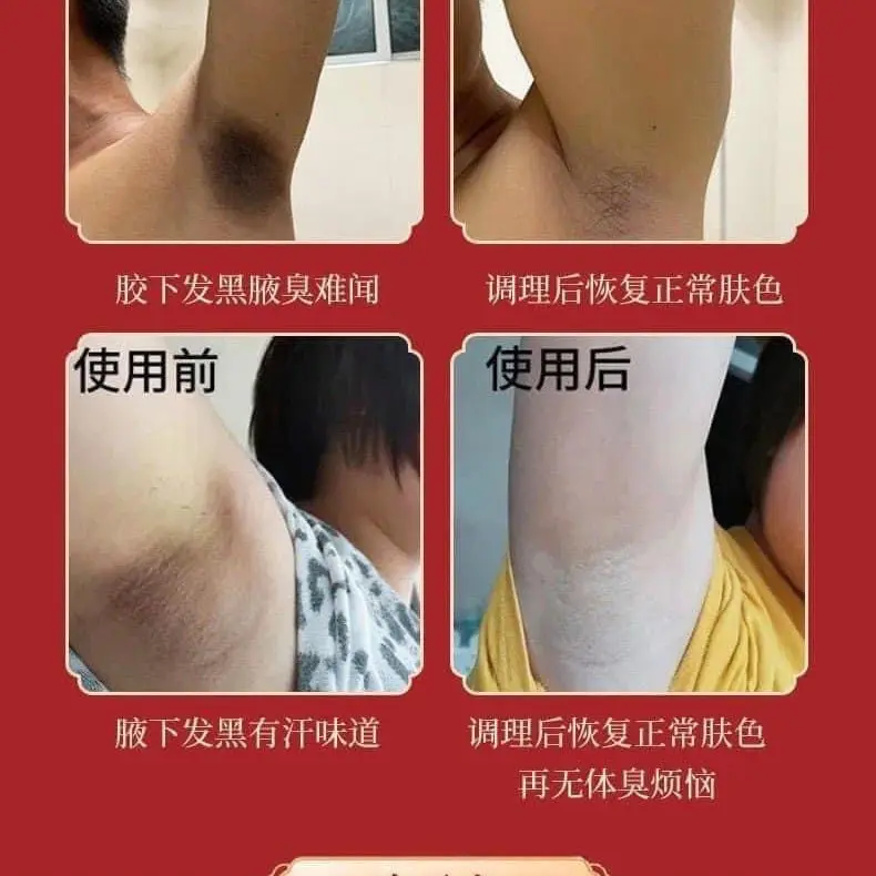 Xịt Nách Hữu Cơ Guangyao Baiyunshan 100ml Khử Mùi Ngăn Tiết Mồ Hôi Hiệu Quả 1