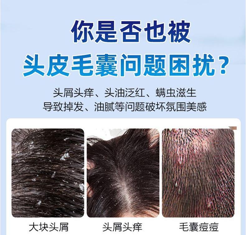 Product Introduction of Xikangwang Anti-Dandruf and Relieve Itching Washing Water Oil Removing Refreshing Skin Washing Cream Anti-Mite Grease-Overflow Moss Lotion 3