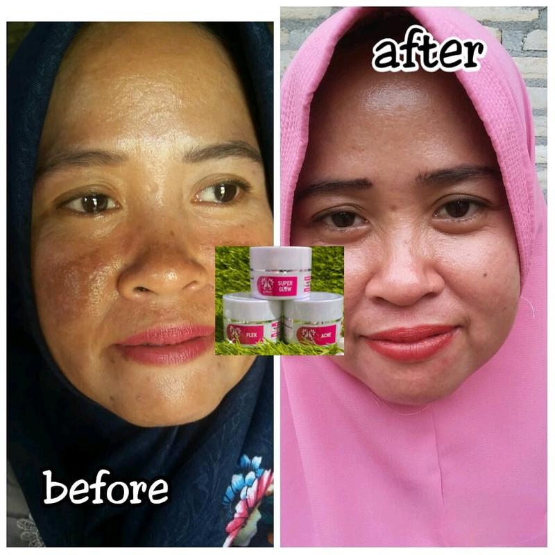 crem flek,glow,acne SPF 30 Semua Jenis Kulit 2