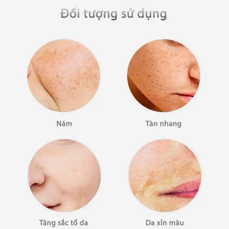 ￼Kem nám trắng da Alpha Arbutin 7% Cream 15 ml (mẫu mới nhất) 1