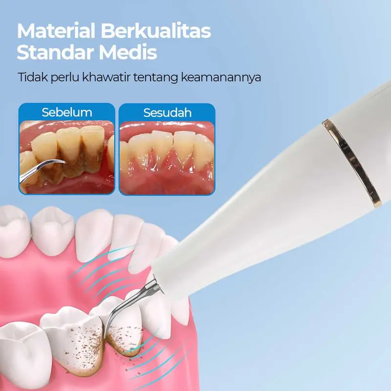 MultiM YUKU Pembersih Karang Plak Gigi Ultrasonic Dental Calculus Electric - GS5 4
