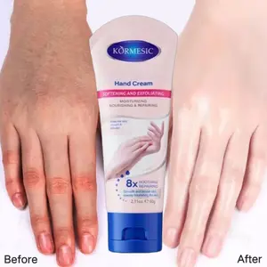 Perbaikan krim tangan pelembab pemutihan pemutihan tangan krim tangan Krim Minyak Tangan Krim Tangan Anti-penuaan Perawatan Kulit Kering Mengupas Perbaikan Pemutih 100% Original Mencegah Kekeringan Mencegah Kaki Retak Krim Pelembab