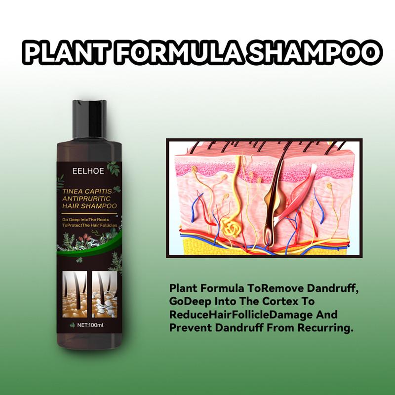 Product Introduction of Antipruritic Hair Shampoo Treat Psoriatic Seborrheic Dermatitis Anti Dandruff Oil Control Damage Repair 5