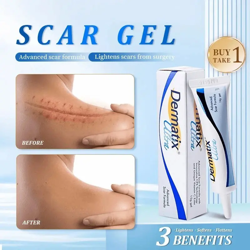 [Ready stock] dermatomix ultra remove scar Hitam stretch mark cream scar removal mosquito bite acne scar old scars treatment