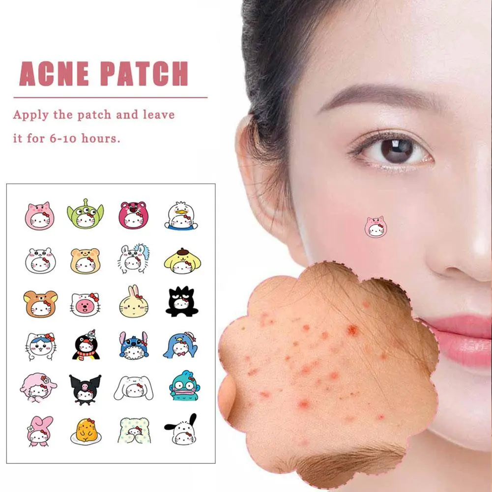 Miếng Dán Mụn Trứng Cá PE Hình Mèo Hoạt Hình, 24 Chiếc, Dễ Thương, V7S9