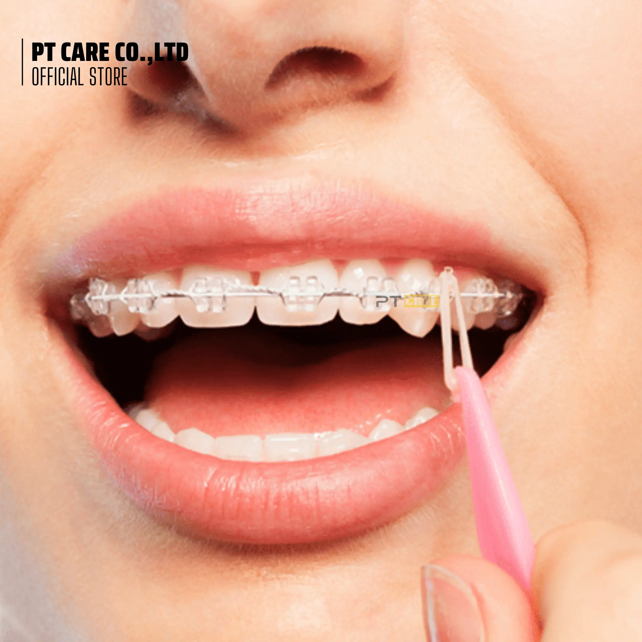 02 Cái Kéo Thun Cây Đeo Chun Liên Hàm Chỉnh Nha Niềng Năng