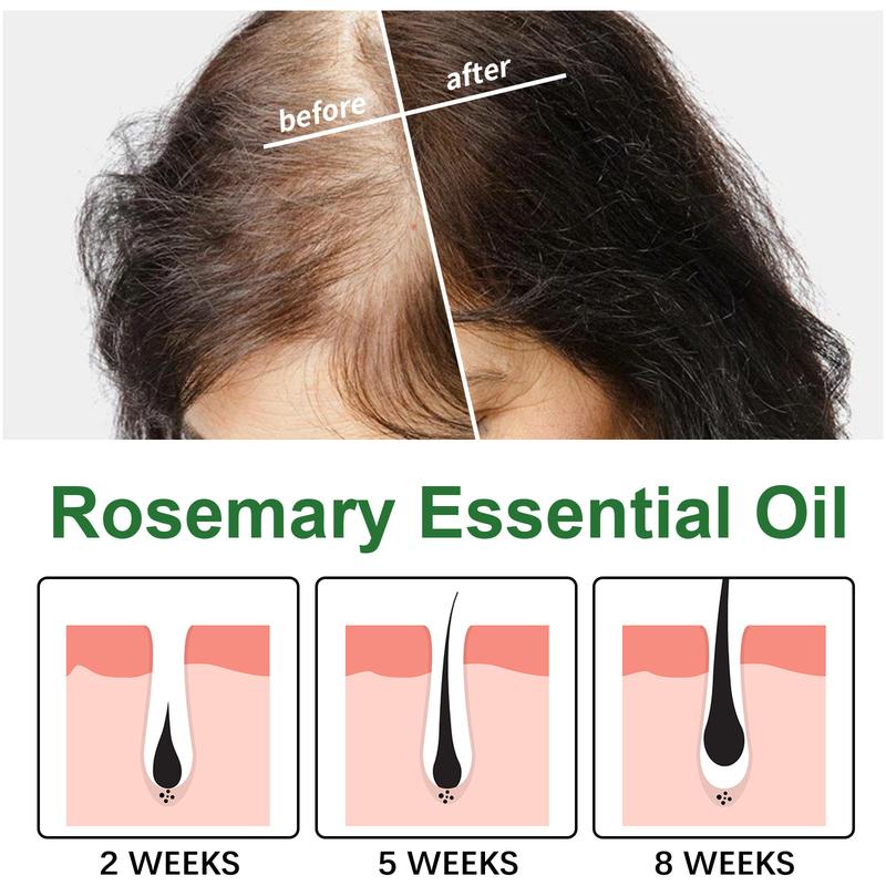 Product Introduction of Rosemary Hair Care Essential Oil Repairs Dry and Frizzy Hair Ends, Nourishes and Softens Hair, and Provides Hair Care Oil 1