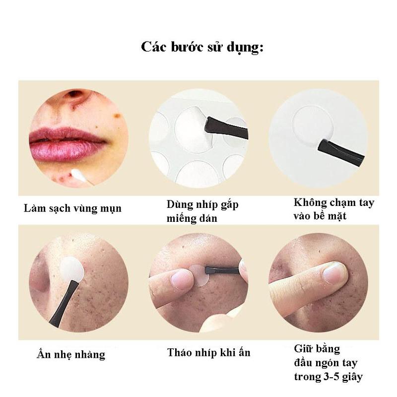 Set Miếng Dán Mụn Trong Suốt- Miếng Dán Hỗ Trợ Mụn- Miếng Dán Che Mụn- HICKIES LACING SYSTEM 1