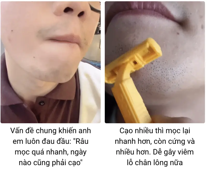 [Nicor] Kem Tẩy Lông 2in1 - Tặng Kèm Kem Dưỡng 4