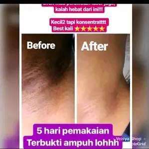 pemutih ketiak &selangkang