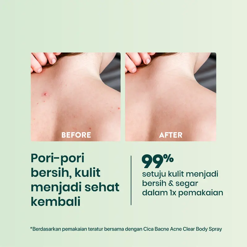 NPURE ACNE+ CLEAR CICA BODY WASH Organik Soap Mandi Tubuh Cair Wangi 1