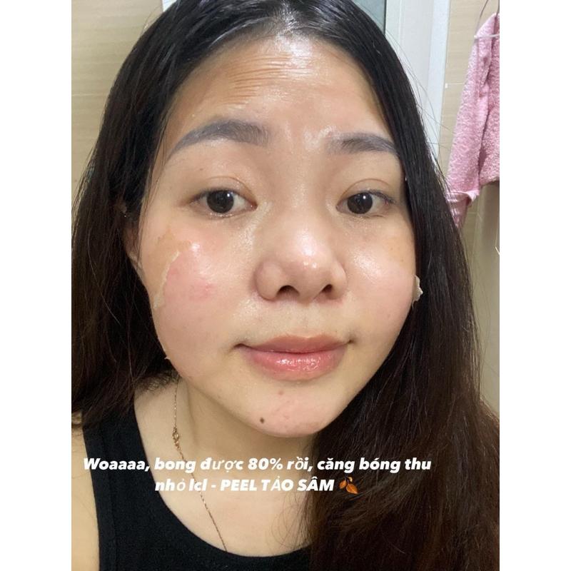 PEEL DA MẶT VI TẢO CAO CẤP - tẩy da chết - giảm mụn thâm mờ nám tàn nhang - thay da sinh học peel lột da mặt retinol 6
