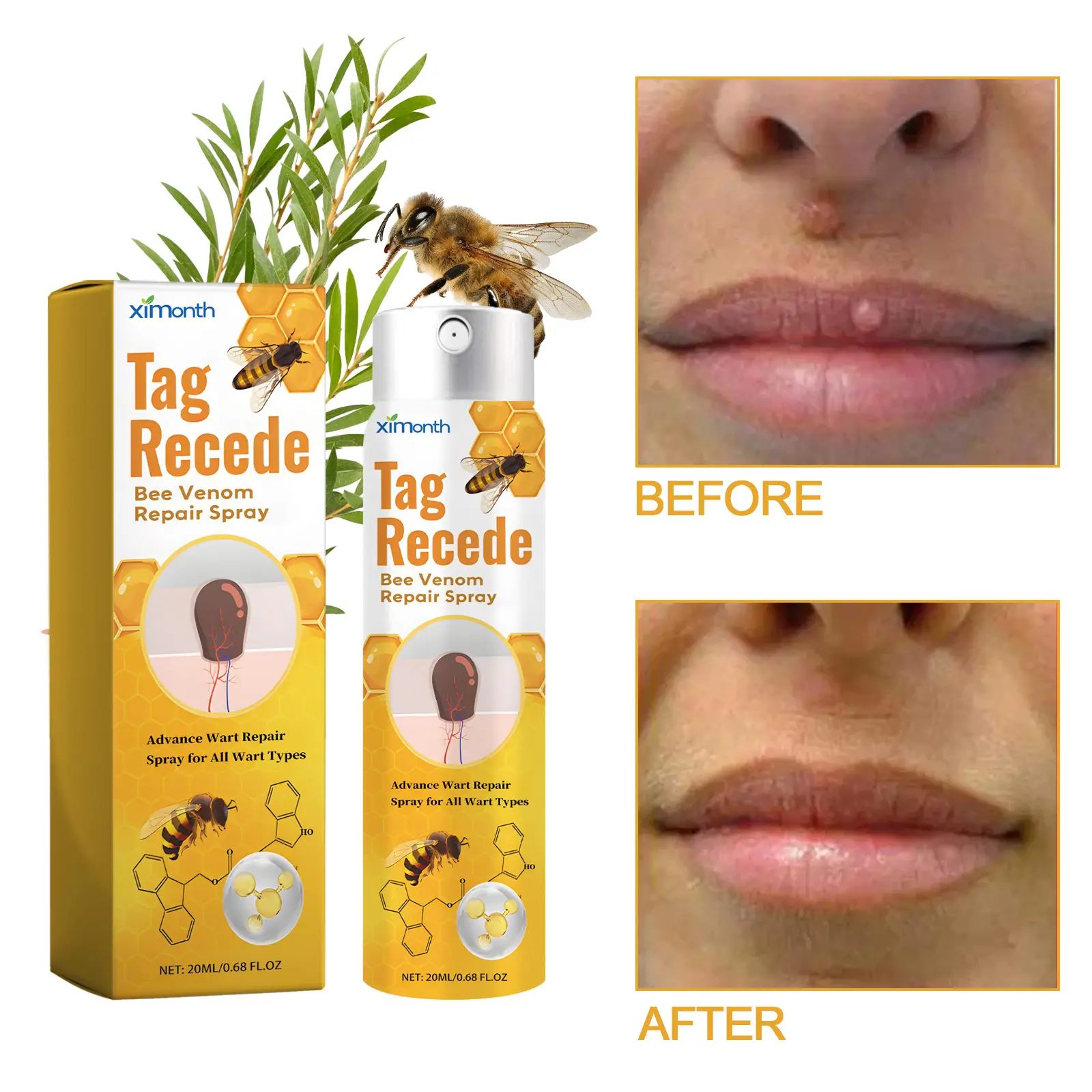 100% Original Brand Bee Venom Wart Care Spray Improve Flesh Bump Meat Mole Repair Smooth Skin Acne Skincare