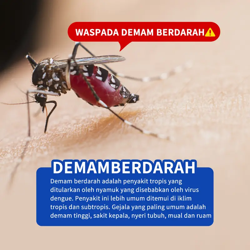 [3Pcs] ULA REFRESHING MIST 50ML*3 Repelling Mosquitoes [BPOM] with Sereh Oil External Use Only x FYC 2