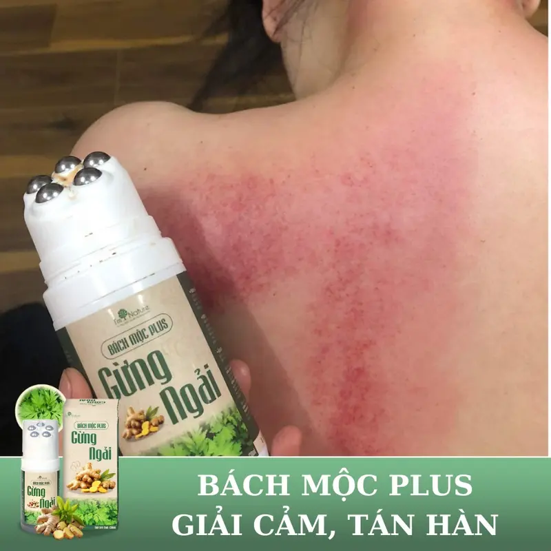 Con Lăn Massage Gừng Ngải - Hỗ Trợ Giảm Đau Lưng, Giảm Nhức Mỏi Cổ Vai Gáy - Cải thiện khả năng vận động - Thành phần thảo dược - Bách Mộc Plus 130ml 1