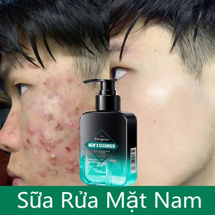Sữa Rửa Mặt Nam Da Dầu Mụn 3 trong 1 Sạch Nhờn Giảm Mụn Dưỡng Sáng Da Giảm Thâm Mụn 160g chai
