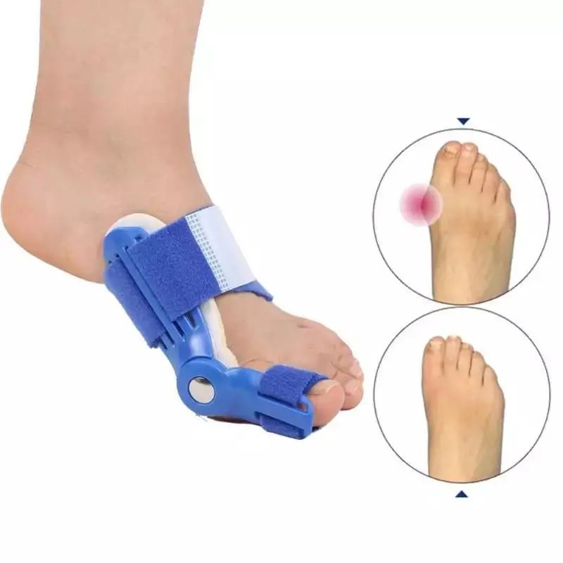 INSOLE KAKI BUNION DAN HALLUX VALGUS CORRECTOR KAKI BUNION INSOLE JARI KAKI BENGKOK TERAPI BUNION Shoe Shoes Wanita