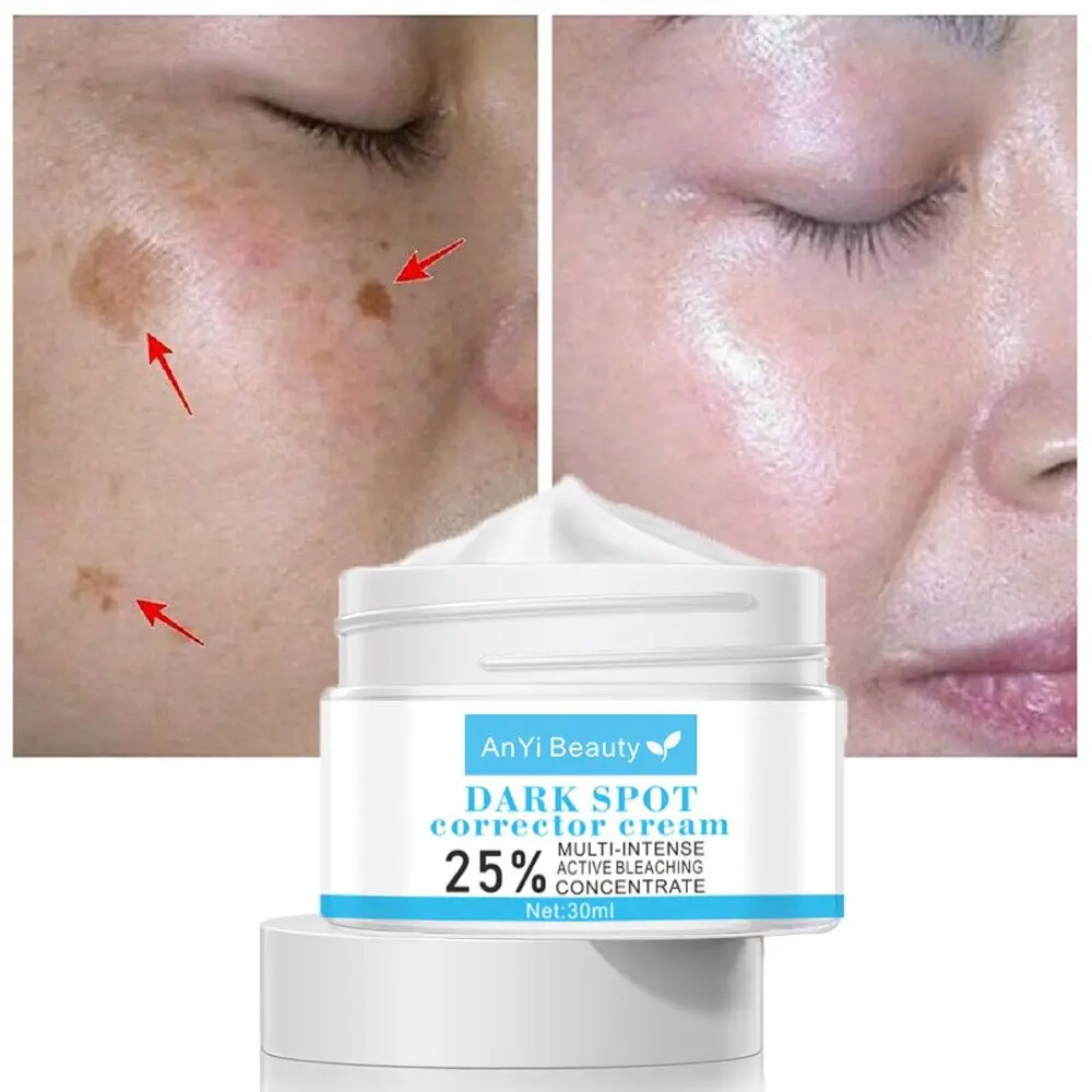 Hot Sale 30g Removal Melasma Whitening Cream Hydrating Moisturizing Dark Spot Corrector Cream Remove Speckle Removal Sunburn Spots Freckle Remover Cream Face