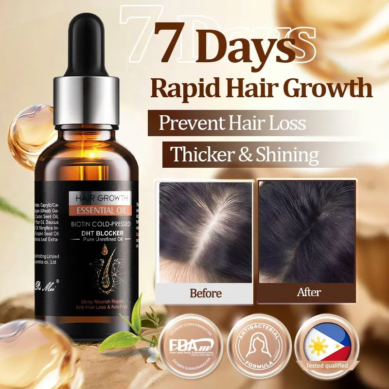 Minoxidil Hair Grower Original Ginger Hair Growth Serum 7X Rapid Growth Hair Treatment 30ml Organic Moisture Nourishing