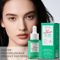 Gambar Kormesic 5in1 Intense Acne Solution Serum 30ml/Serum Wajah - 5in1 Serum, Kormesic dari Tokoserba serbu Kota Administrasi Jakarta Barat 4 Tokopedia