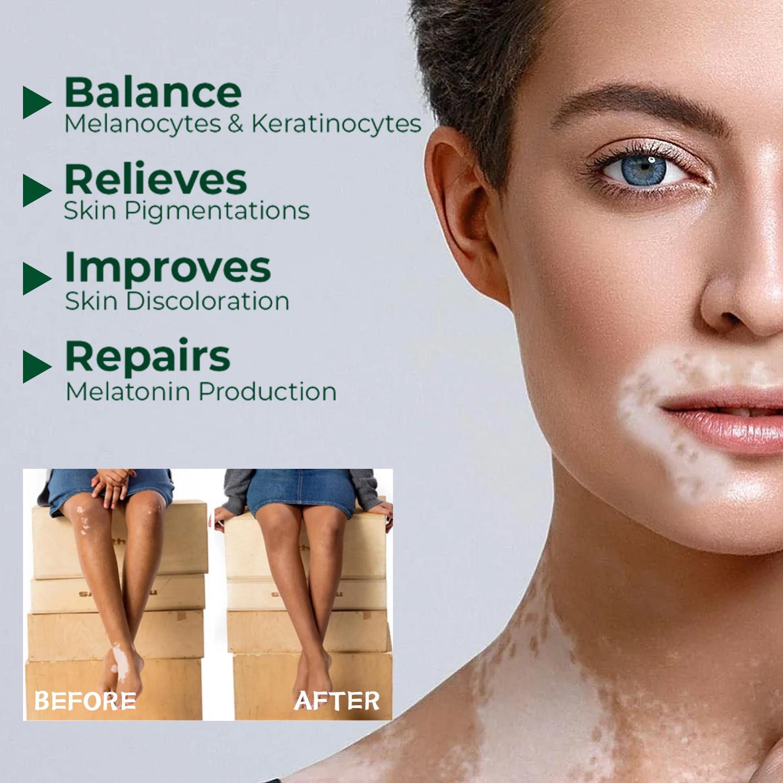 Pengiriman Cepat Prioritas Pengiriman Krim Perawatan Kulit South Moon Krim Perawatan Eksternal untuk Membersihkan, Melembapkan, dan Memperbaiki Kulit Tubuh Mengurangi Ketidaknyamanan