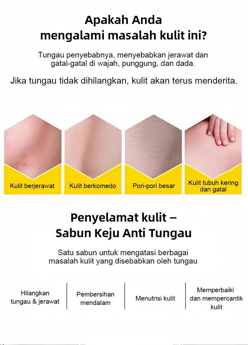 【COD】Sabun Keju – Mencerahkan, Atasi Jerawat, Kontrol Minyak + Jaring Busa