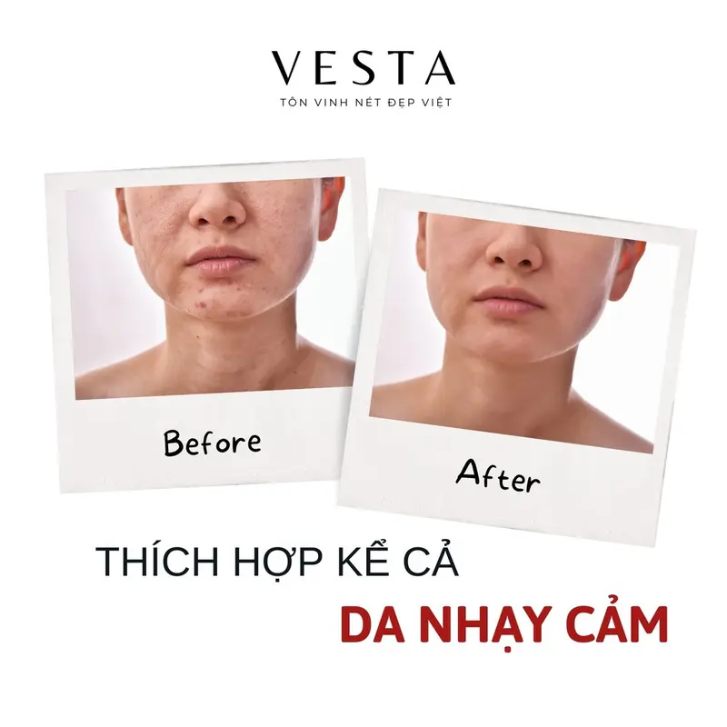 Mặt nạ nhau thai cừu nhật mask giấy rwine dưỡng da dưỡng ẩm 40ml - Shin Shop 2