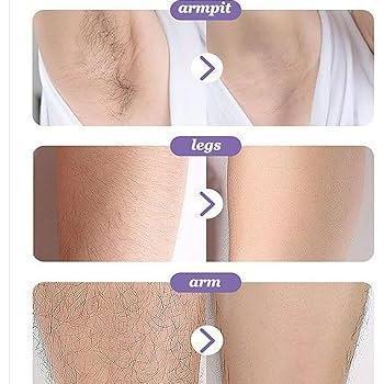 Perontok Bulu Kingyes Hair Removal Foam 150ml Spray Semprot Penghilang Bulu Ketiak Kumis Kaki Tangan Tanpa Rasa Sakit - Pencabut, Jenggot Wax 8