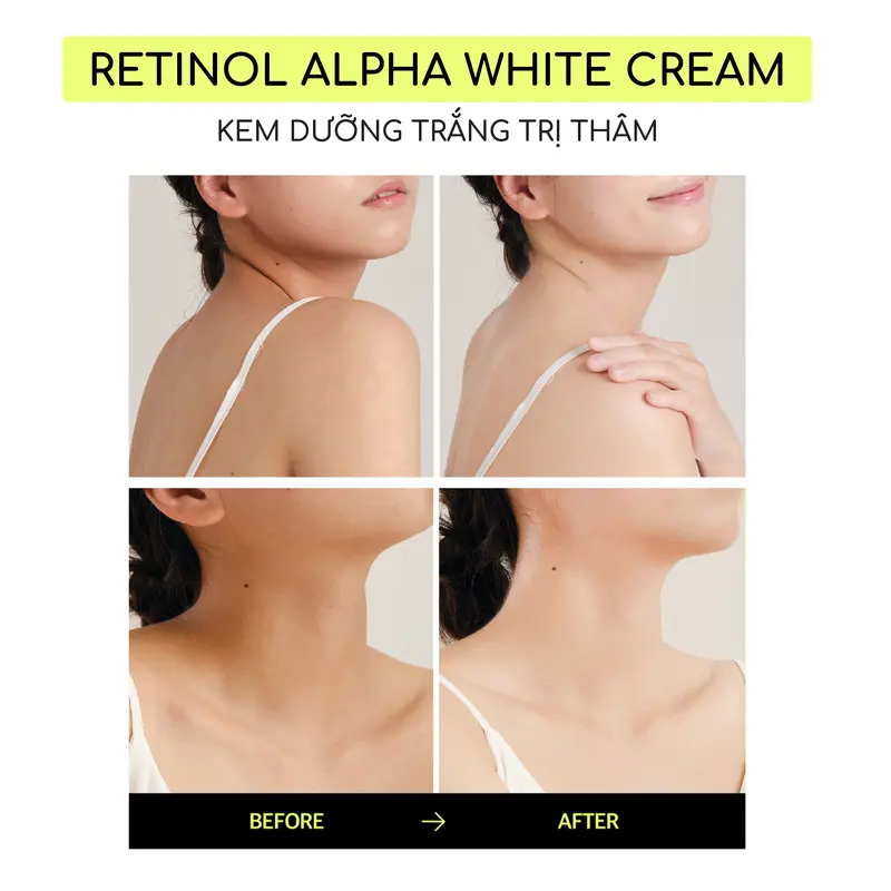 [HÀNG TẶNG KHÔNG BÁN] Kem dưỡng trắng mờ thâm Logically,Skin Retinol Alpha White Cream 40g 2