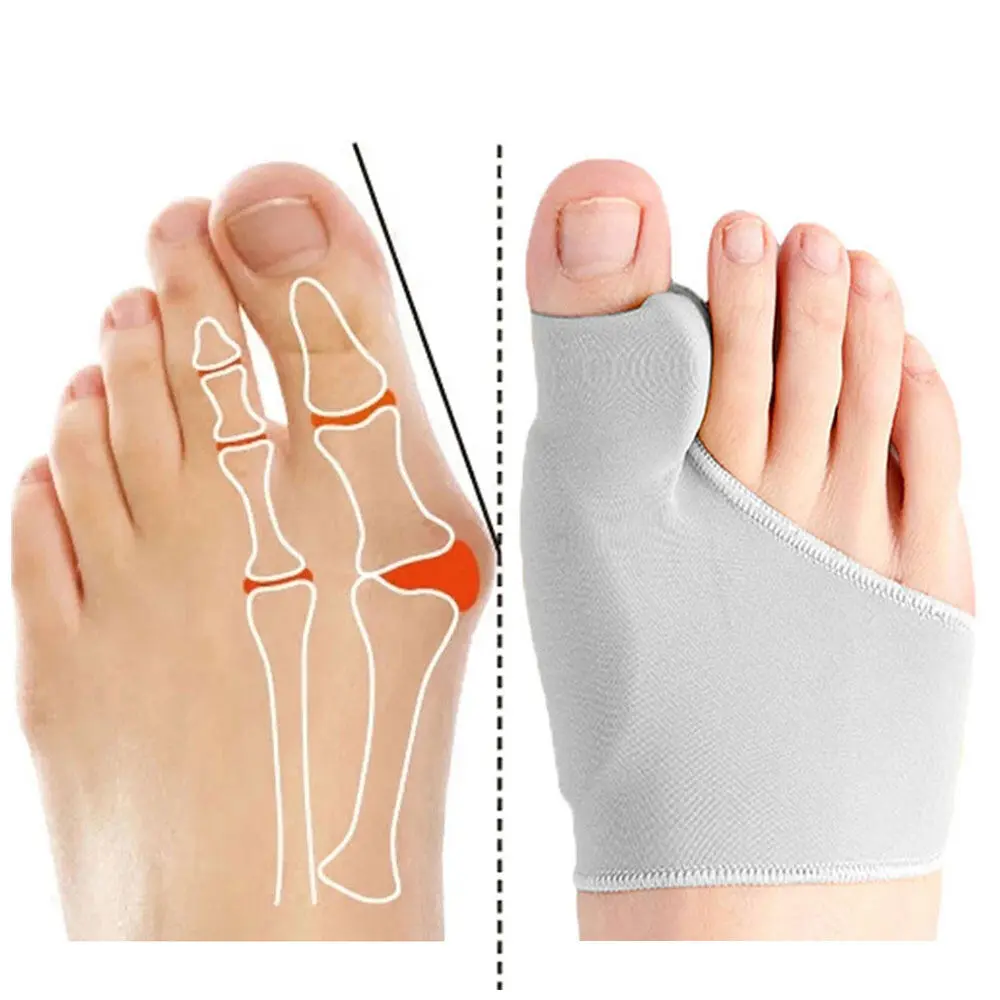 Dụng Cụ Tách Ngón Chân Cái, Dụng Cụ Chỉnh Sửa Bunion Hallux Biến Dạng, Dụng Cụ Chỉnh Hình Xương Bàn Chân, Dụng Cụ Điều Chỉnh Ngón Tay Cái, Vớ Móng Chân Định Hình, Dụng Cụ Duỗi Thẳng