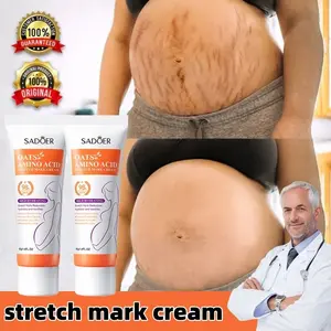 Krim Penghilang Stretch Mark Ori BPOM Stretch Mark Treatment Cream Krim Anti Strechmark Aman untuk Bumil dan Busui dan Selulit Menghilangkan Stretch Mark dengan Efektif BPOM Original Penghilang Stretch Mark Cream Penghilang Bekas Luka