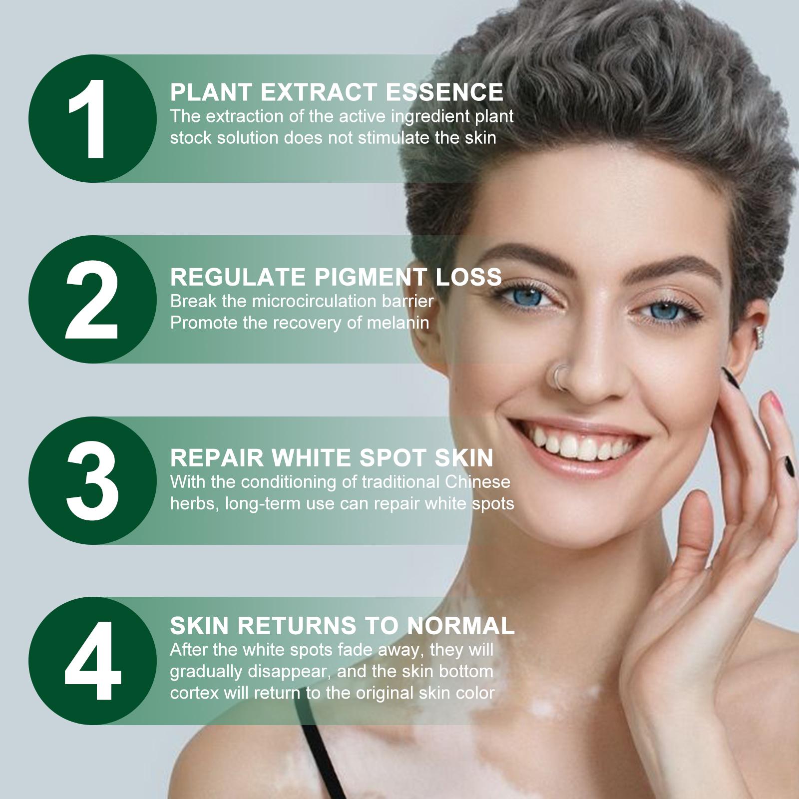 Pengiriman Cepat Prioritas Pengiriman Krim Perawatan Kulit South Moon Krim Perawatan Eksternal untuk Membersihkan, Melembapkan, dan Memperbaiki Kulit Tubuh Mengurangi Ketidaknyamanan