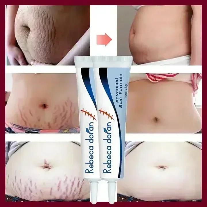 Product Introduction of Maternity Cream That Enhances Elasticity, Gentle Skin Care After Pregnancy, Eliminates Stretch Marks, and Is Very Effective body  moisturizers 19