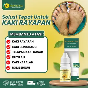 Propolis SM Salep Oles Atasi Kaki Rayapan Telapak Kaki Bau Rombeheun Berlubang Kaki Korodok Untuk Anak dan Dewasa