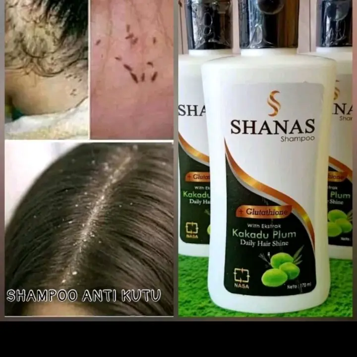 ANTI KUTU//PEMANJANG RAMBUT//ANTI RONTOK//SHANAS SHAMPO Shampoo