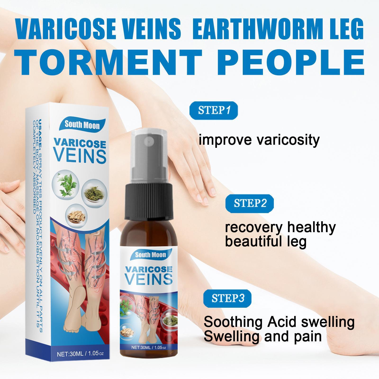 Semprotan Varises yang Kuat dan Menenangkan Obat Varises Salep Penghapus Varises Efektif Vaskulitis / Varises Tanpa Operasi / Salep Varises Asli Krim Varises Terbaik Perawatan Kaki Varises