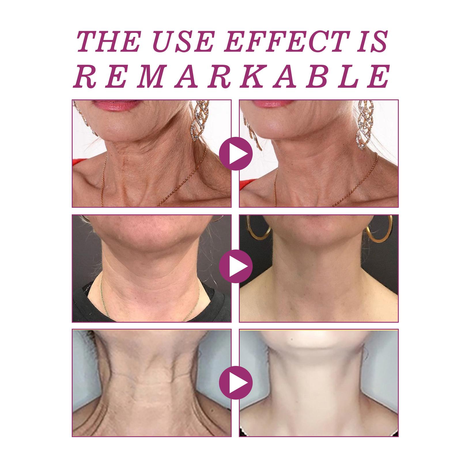 Jaysuing krim leher kolagen hidrolisasi, menghilangkan garis leher, bentuk leher angsa, Krim leher putih halus Hitam Mengencangkan Mencerahkan Perawatan Kusam Memudarkan