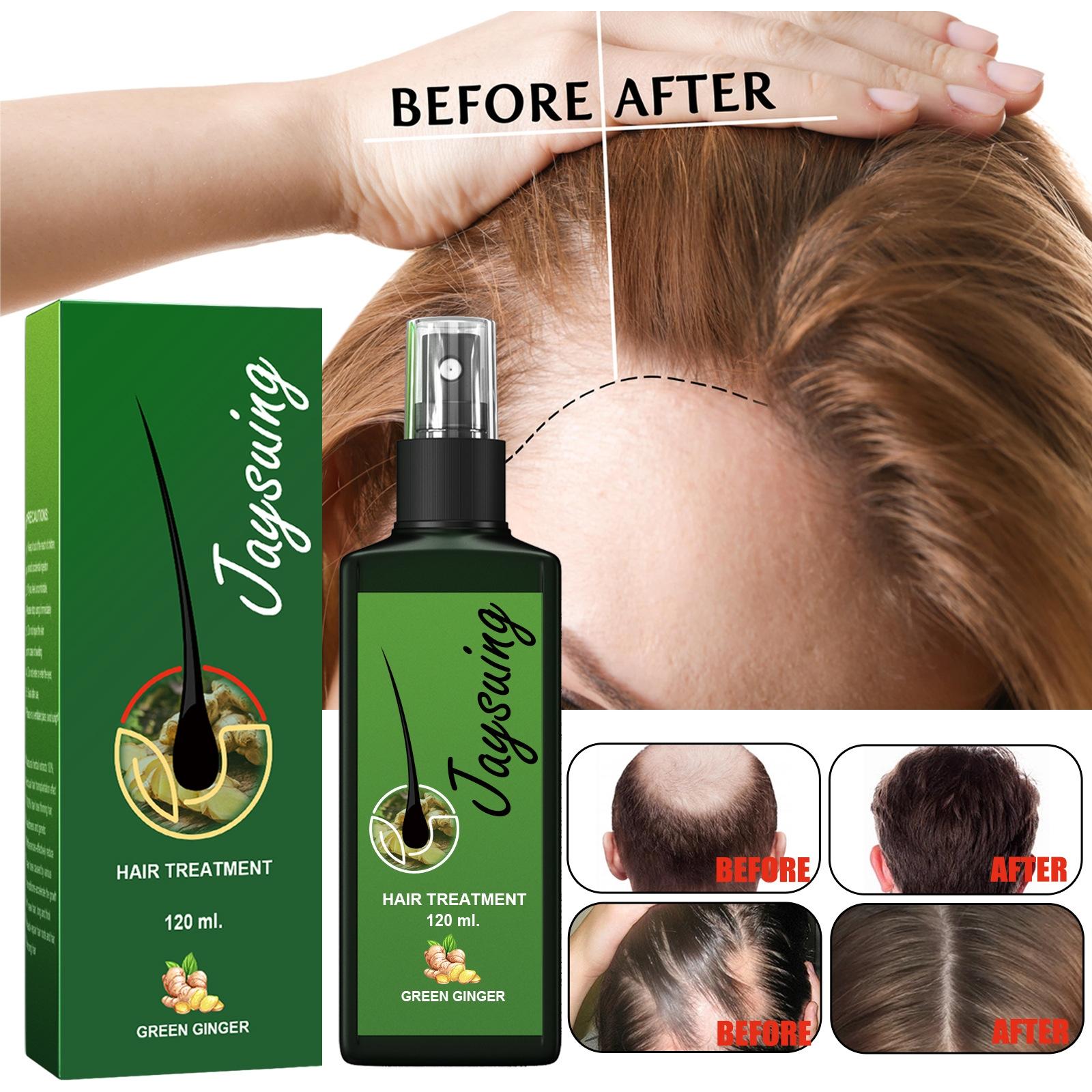 jaysuing ginger hair growth spray penumbuh rambut cepat serum penumbuh rambut botak hair tonic rambut rontok 120ml