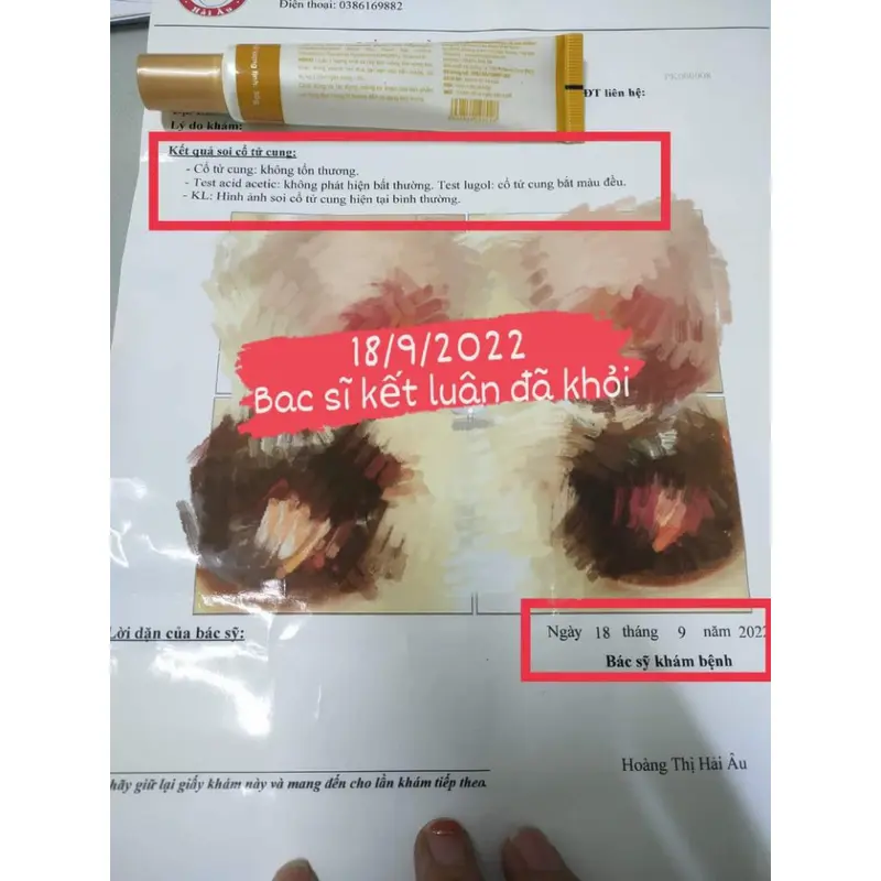 Gel Nano bạc Woman Silver Gel tặng 5 bơm   vệ sinh phụ nữ  Táo Xanh Việt Nam Hàng chính hãng 6