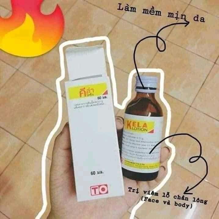 Dung dịch Kela Lotion 30ml/60ml Thái Lan 3