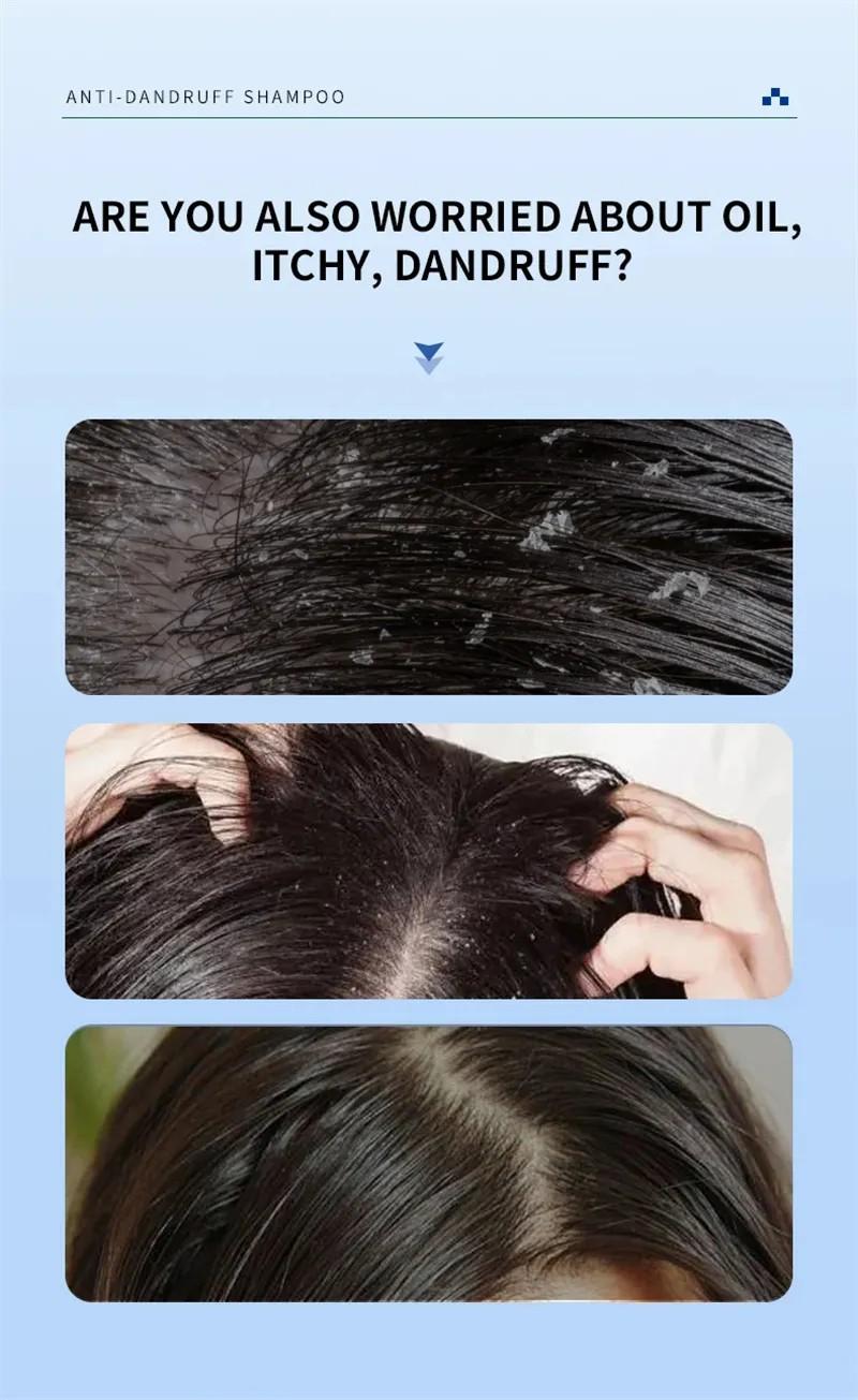 Sampo Ketombe 300ml untuk psoriasis, pereda gatal akibat selenium disulfida, sampo anti ketombe, pengontrol minyak