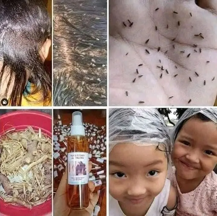 Rượu ủ chấy gia truyền đặc trị chấy