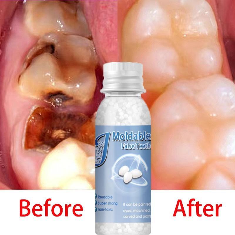 Dekorasi Gigi Gaya Film dan Televisi, Cairan Perbaikan Gigi Hilang yang Laris Dijual Meredakan Nyeri Gusi Ketidaknyamanan Mulut Pereda Sakit Gigi Perawatan Menyegarkan Perbaikan Pembersihan Perawatan Gigi Tetes Pereda Gigi