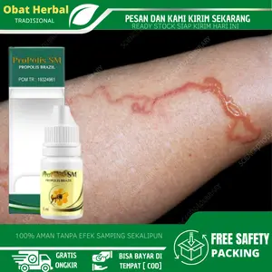 Penghilang Cacing Tambang di Kulit, Salep Gatal Cacing Pasir, Cacing Pasir, Pembasmi Cacing Kulit, Infeksi Cacing Kulit, Cutaneous Larva Migrans