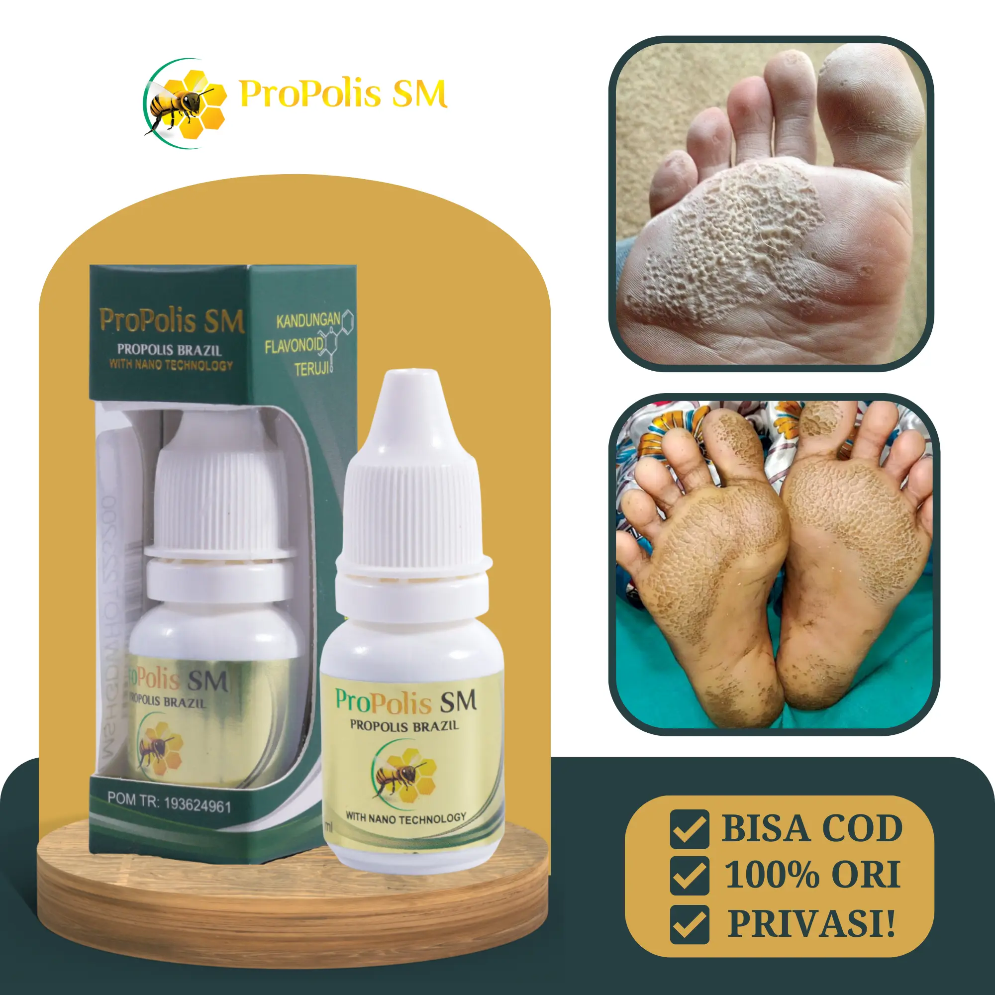 Propolis sm - Telapak kaki Rayapan bau dan Rorombeheun korodok