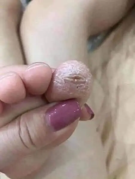 Kem Bôi V.iêm Da C.ơ Đ.ịa, N.ấm Ng.ứa, Á Sừng Lão Gia JIMINGTANG 2