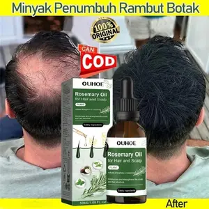 50ml Rosemary Oil Rambut Penumbuh Rambut Botak Penumbuh Rambut Botak Perawatan Rambut Rontok/ Alami Murni Minyak Esensial Rambut Rosemary/Penumbuh Rambut Cepat /Hair Growth Oil Untuk Rambut Rontok Memperbaiki Rambut Kering Dan Rusak [W62]