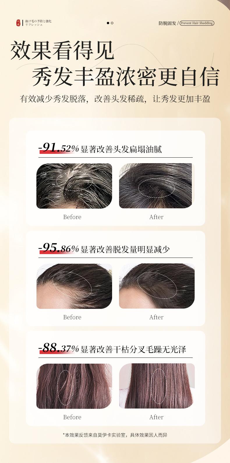 Product Introduction of Anti-hair removal shampoo hair care hair fixation hair repair anti-dandrucleansing and oil controlling shampoo 9