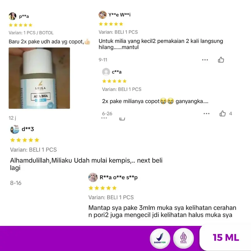 PAKET KHUSUS MILIA SYRINGOMA !! Paket 2in1 milia syringoma Cream & serum yang di formulasikan khusus untuk mengatasi milia serum cream Leika Skincare 4